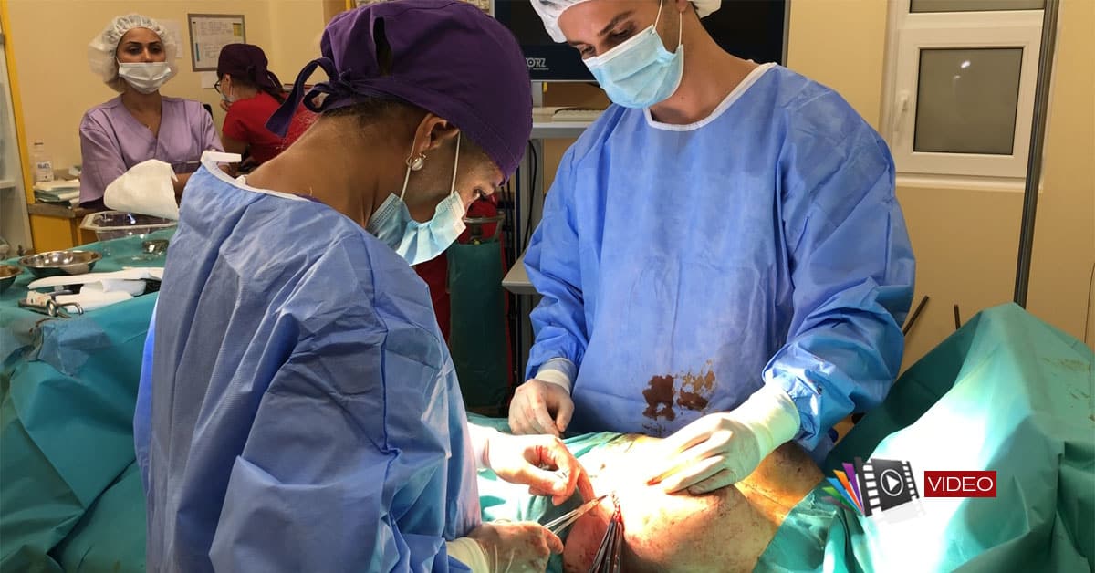 Excizie tumoră benignă și augmentare mamară