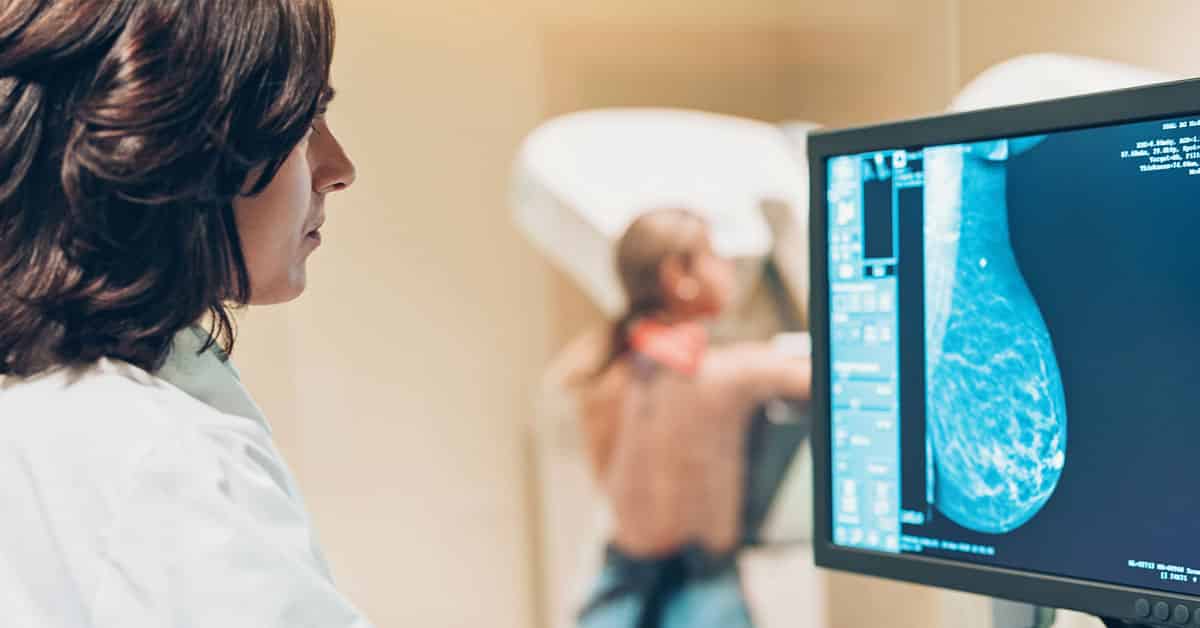 Riscul de a dezvolta cancer mamar: scorul BIRADS