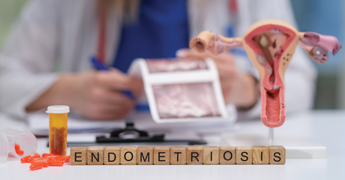 Când ai nevoie să faci operația de endometrioză?