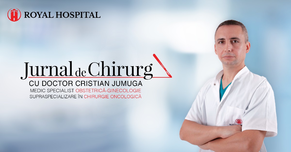 Mastectomie stângă cu ganglion santinelă și reconstrucție cu expander tisular